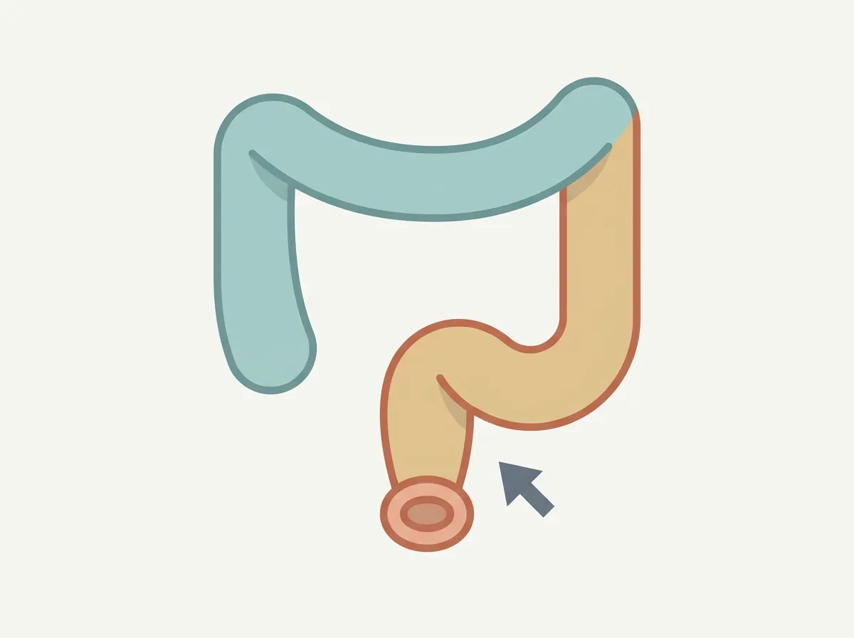 Diagram: Thin Stools: What Narrow or Pencil-Thin Poop Can Mean — detail